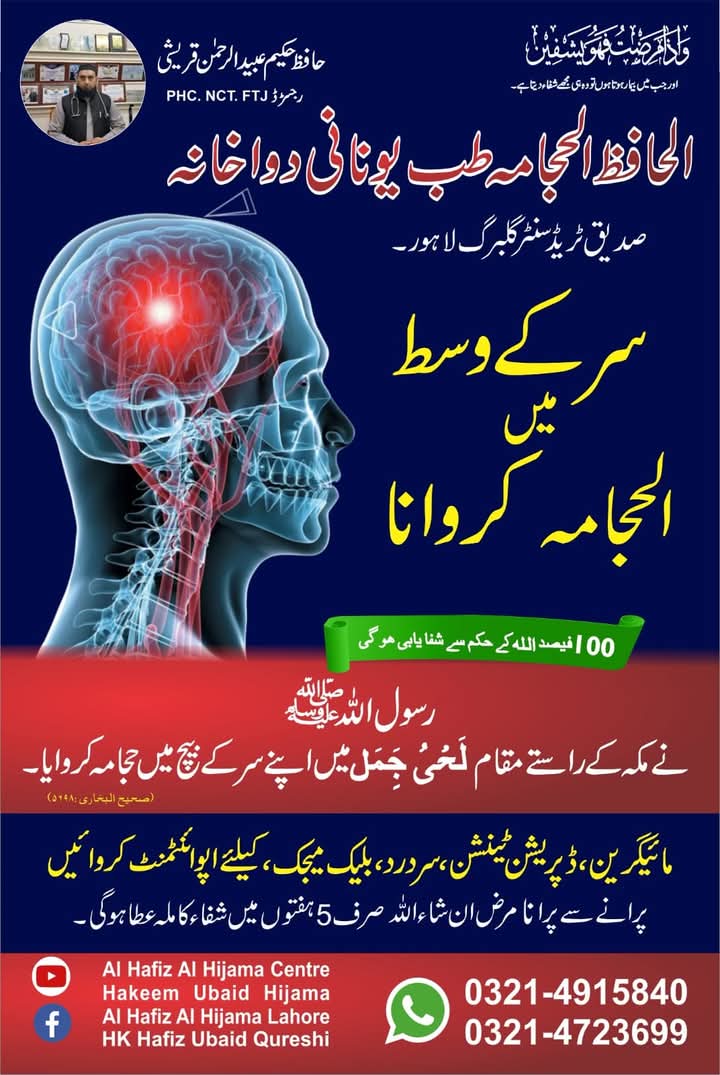 migraine hijama points for headache