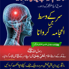 migraine hijama points for headache